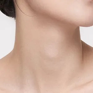 imgi_54_Skin_Concerns_02_large_7eda379c-427a-4dbe-97bf-d9ec65ba9919